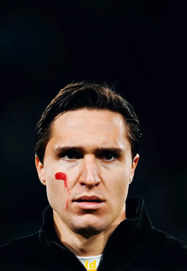 拉齐奥VS乌迪内斯直播_拉齐奥VS乌迪内斯免费在线高清直播_拉齐奥VS乌迪内斯视频在线观看无插件